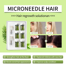 Load image into Gallery viewer, Infuse Hair Regrowth System, Advanced Hair Growth Treatment | USA Brand Same Day Shipping