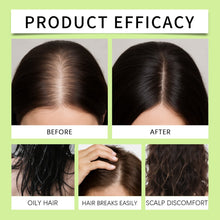 Load image into Gallery viewer, Infuse Hair Regrowth System, Advanced Hair Growth Treatment | USA Brand Same Day Shipping